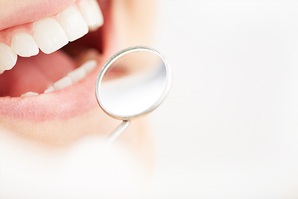 唾液検査で虫歯予防（予防ケア）